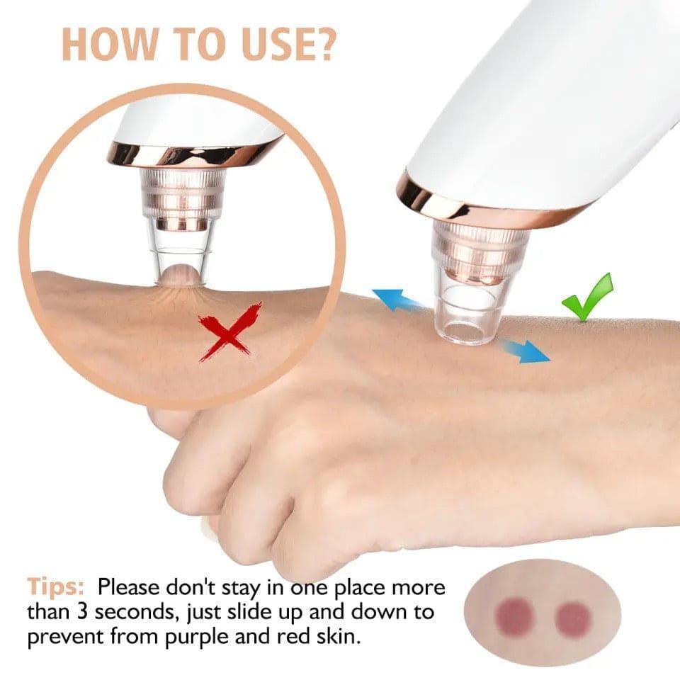Electric Blackhead Remover & Facial Pore Cleaner